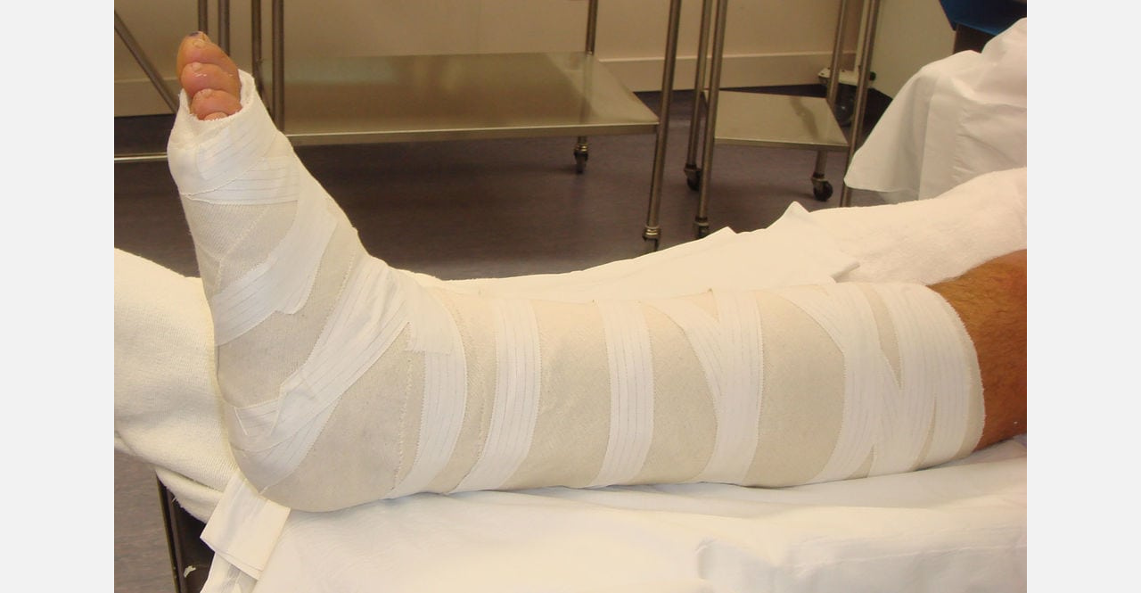 Очнулся — гипс: сломав ногу дома, житель Златоуста намерен доказать, что травма «на удалёнке» – производственная